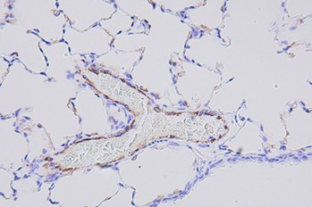 IHC-CD31.jpg